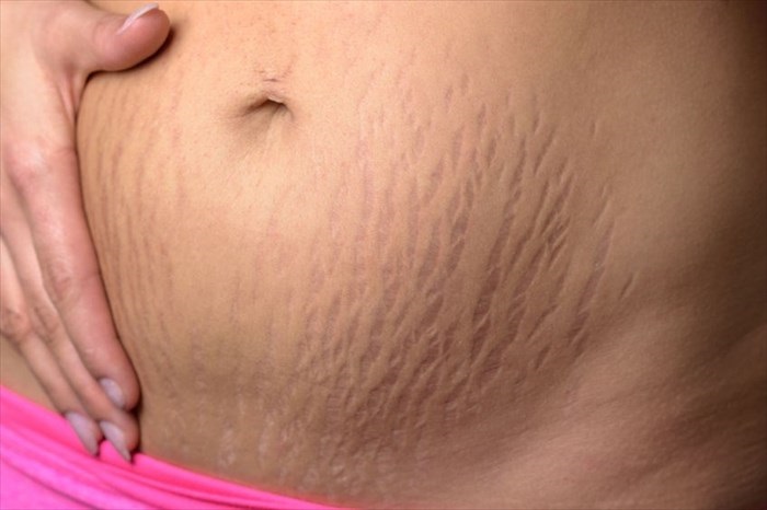 AVS PLASTIC SURGERY AND SKIN CLINIC Pudukkottai