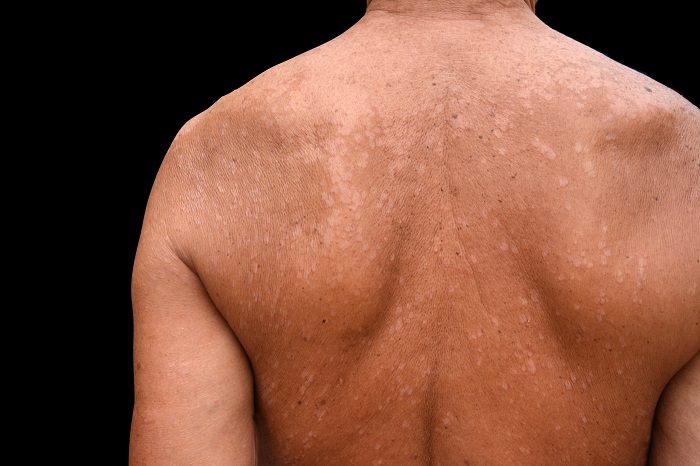AVS PLASTIC SURGERY AND SKIN CLINIC Pudukkottai